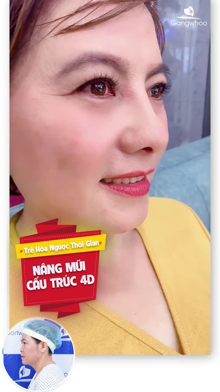 NÂNG MŨI NANOFORM 4D - DÁNG MŨI TRẺ HÓA NGƯỢC THỜI GIAN