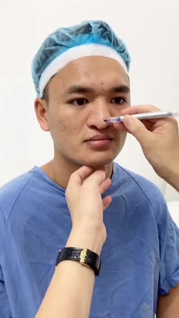 Thăm khám, đo vẽ khách hàng sứt môi hở hàm ếch cùng bác sĩ!