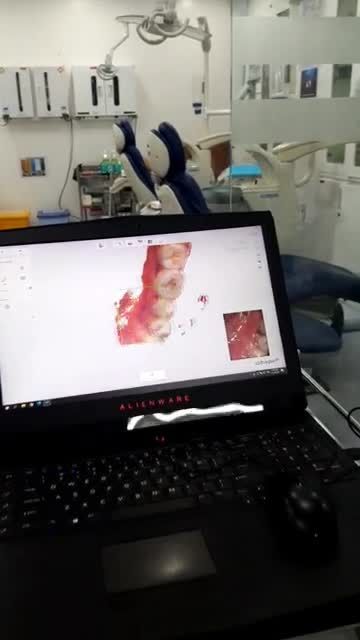 Ứng dụng  Công nghệ scan 3D trong phẫu thuật hàm mặt và nha khoa độ chính xác tuyệt đối