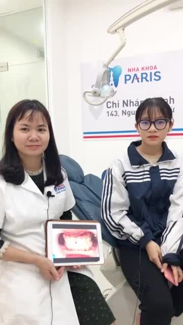 KHÁCH HÀNG CHIA SẺ CẢM NHẬN SAU BỌC 2 RĂNG SỨ BIO PARIS