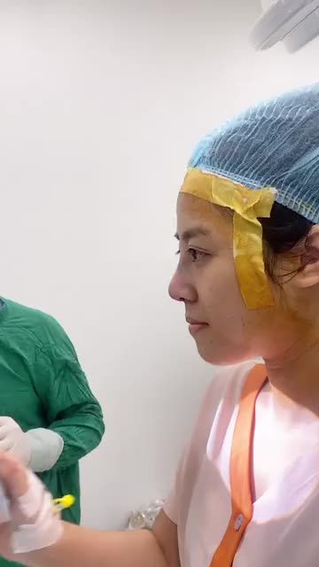 Tái tạo dáng mũi tự nhiên cho khách hàng từng nâng nhân tạo