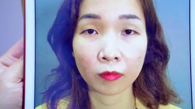 Trẻ ra 10 tuổi nhớ Cắt mí bạn có tin?