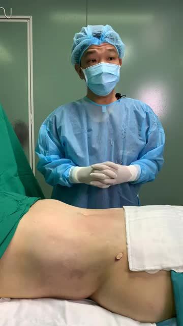 Bụng khách hàng Lâm Đồng TO NHƯ BẦU hóa Gang Tay chỉ trong phút chốc