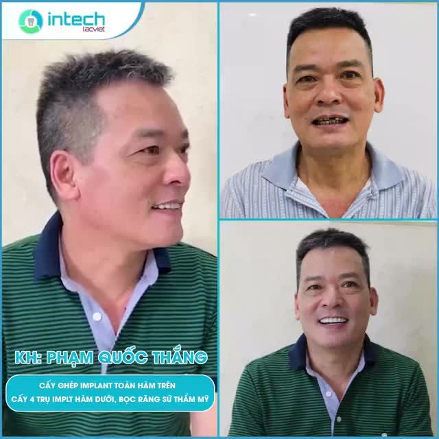 MẤT RĂNG KHÔNG CHỈ LÀ THẨM MỸ MÀ CÒN LÀ SỨC KHOẺ