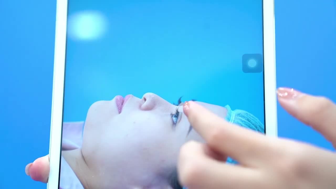 Nâng mũi ME SHAPE- Độc quyền Dr Minh Phạm108: