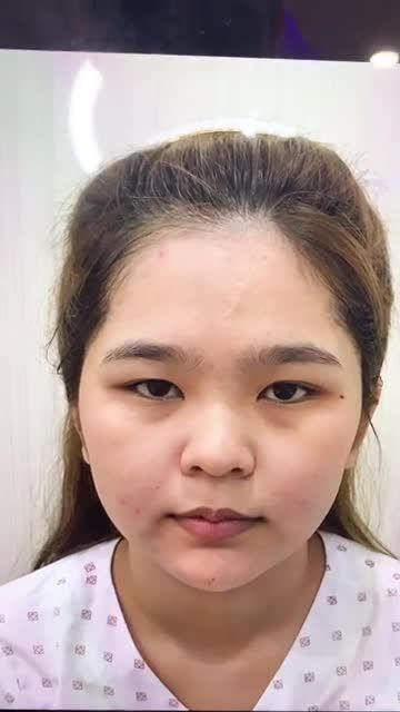 Bạn gái đã thay đổi toàn diện chỉ với 15 Ngày làm đẹp tại TMV Gangwhoo
