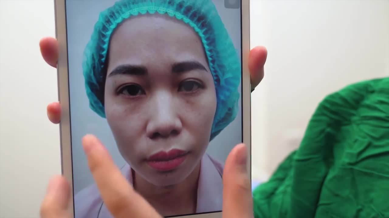 MẶT VUÔNG , CẰM LẸM , TRÁN LÕM, GƯƠNG MẶT GÓC CẠNH