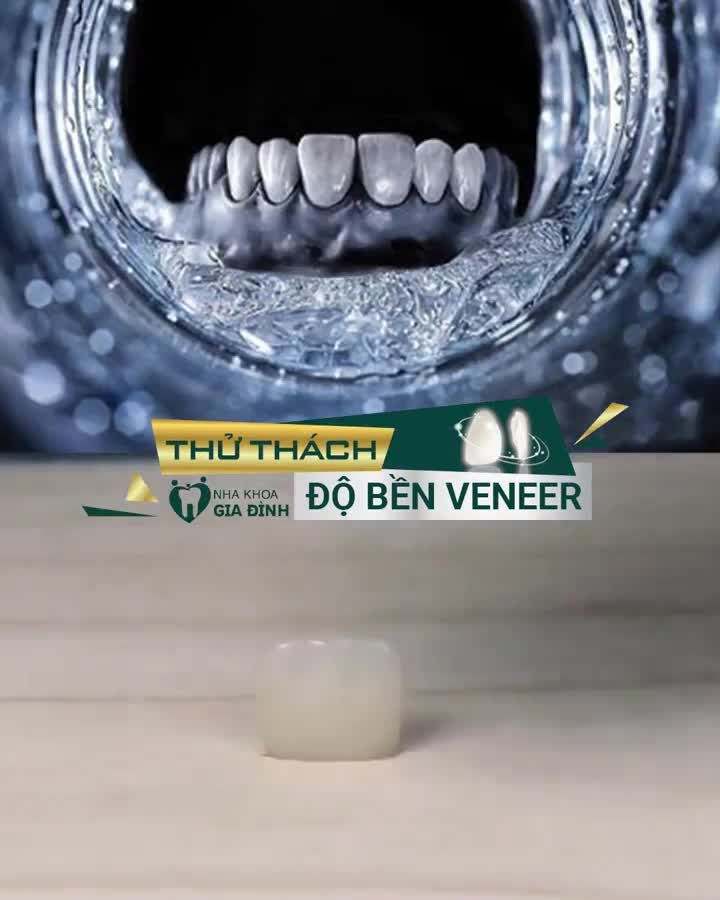 DÁN SỨ VENEER – NỤ CƯỜI ĐẸP THÁCH THỨC THỜI GIAN
