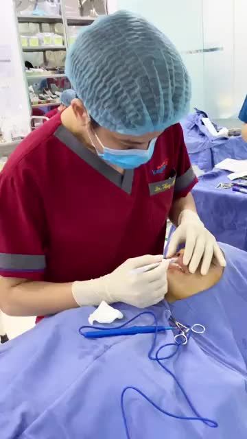 Môi dày, không rõ viền khiền gương mặt mất điểm, tự ti