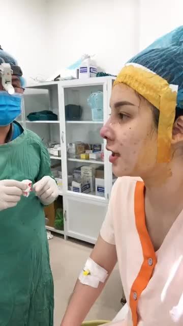 Lợi ích việc xem lại dáng mũi trước khi đóng vết khâu