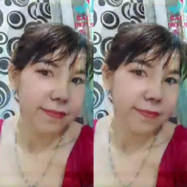 NÂNG MŨI NHÀ BS KỲ Y DƯỢC Nâng Mũi Bán Cấu Trúc Sụn Tai Đa Lớp