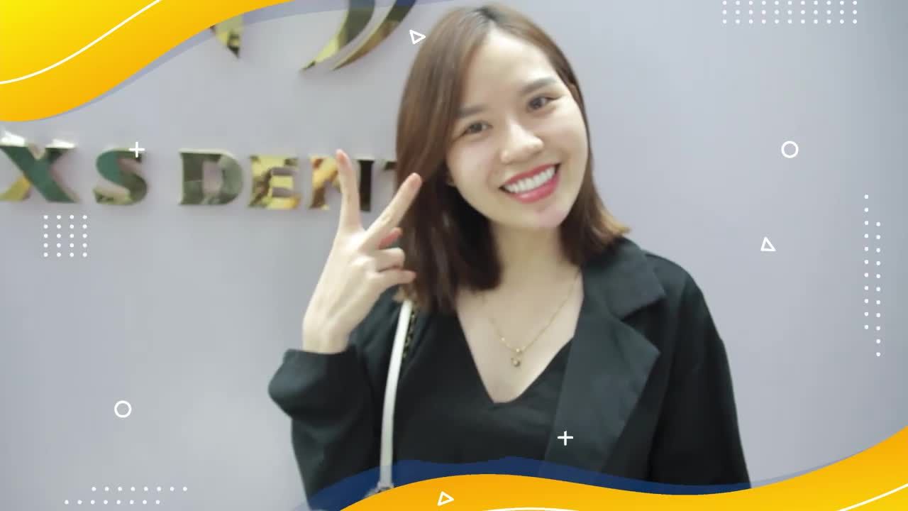 Chị Thanh tái khám sau gần 1 năm làm răng sứ thẩm mỹ Tại Nha Khoa XS Dental .