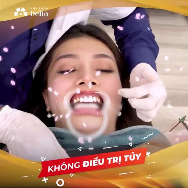 DÁN SỨ VENEER - GIẢI PHÁP HOÀN HẢO CHO HÀM RĂNG TRẮNG SÁNG, KHỎE MẠNH