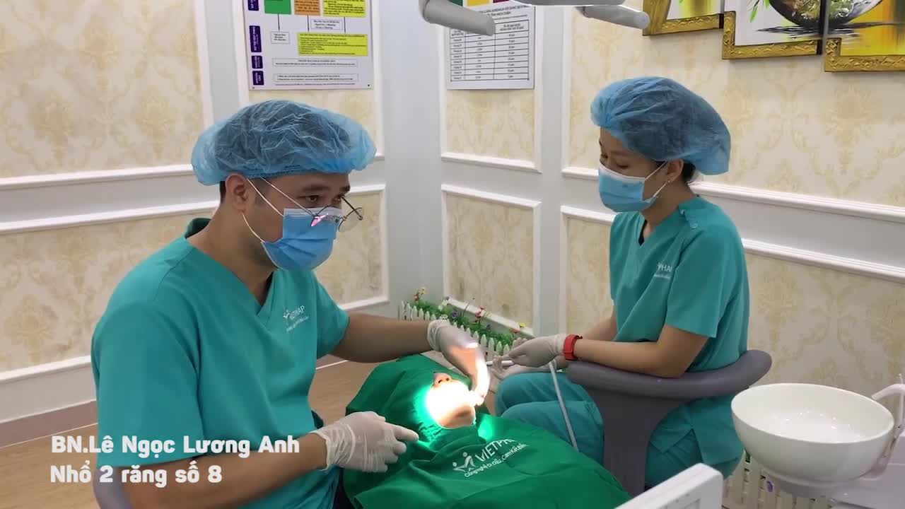 NHỔ CẶP RĂNG 8 MỌC NGHIÊNG 45 ĐỘ CHO KHÁCH HÀNG
