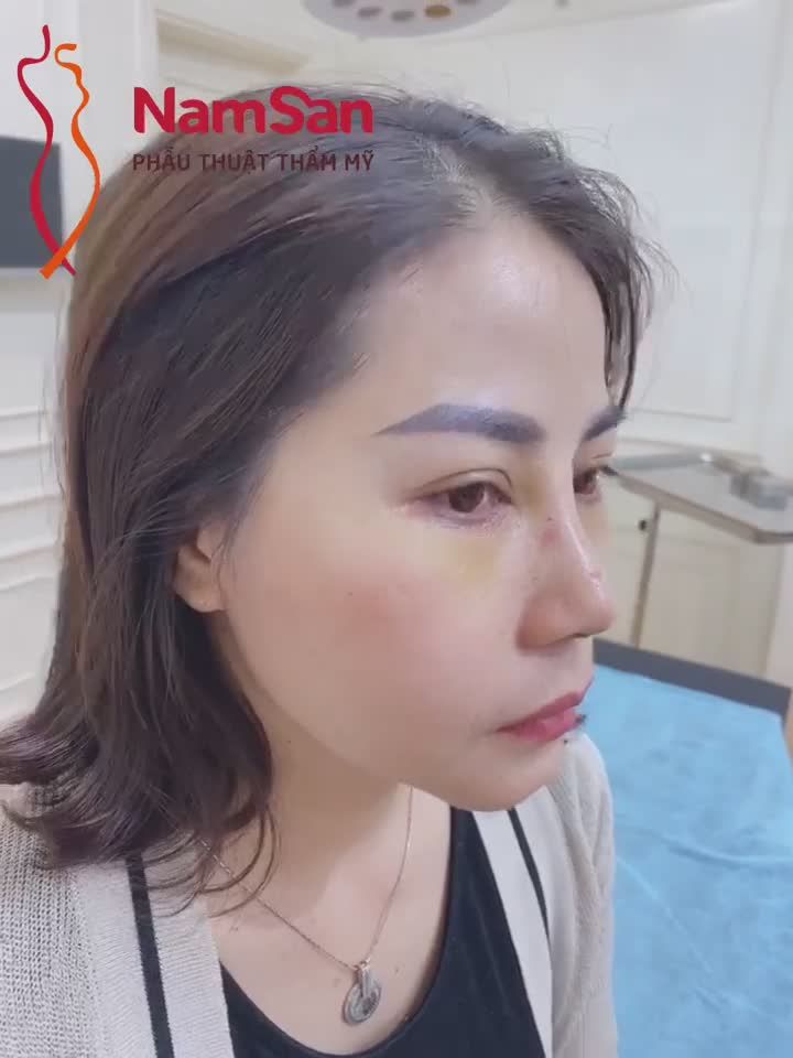 Phẫu thuật thẩm mỹ để bạn không phải để trở thành người khác mà là hoàn thiện hơn nét đẹp của chính mình mỗi ngày.