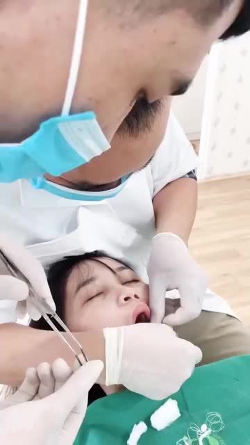 THẨM MỸ TRỌN BỘ 14 RĂNG SỨ E.MAX CHO KH TẠI CS1. SỐ 3 NGUYỄN NGỌC VŨ