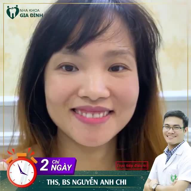 ĐÃ ĐẾN LÚC BẠN CẦN THAY ĐỔI HÀM RĂNG KHIẾM KHUYẾT CỦA MÌNH