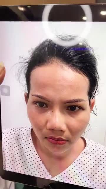 Dáng Mũi 3D Cực Tây thay đổi ngoạn mục đối với chị khách hàng tại Gangwhoo Hotline: 0931780090