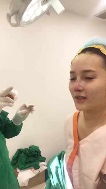 Khách hàng da mũi mỏng nên nâng mũi như thế nào?
