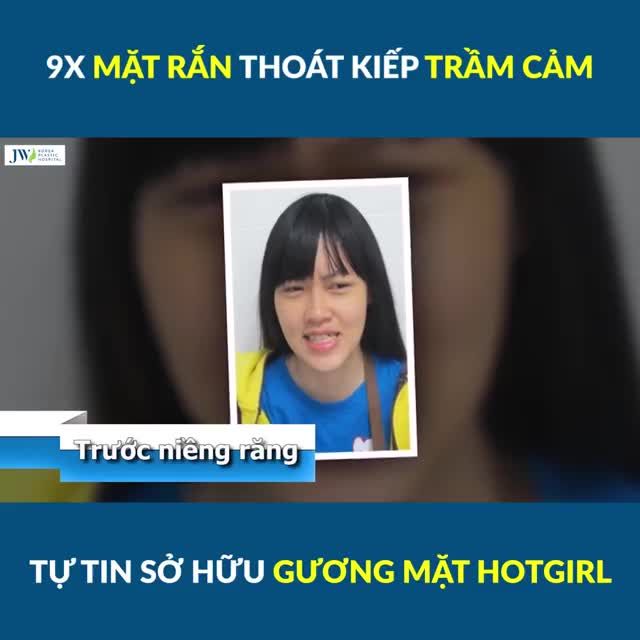 9X MẶT RẮN THOÁT KIẾP TRẦM CẢM NHỜ THAY ĐỔI GƯƠNG MẶT