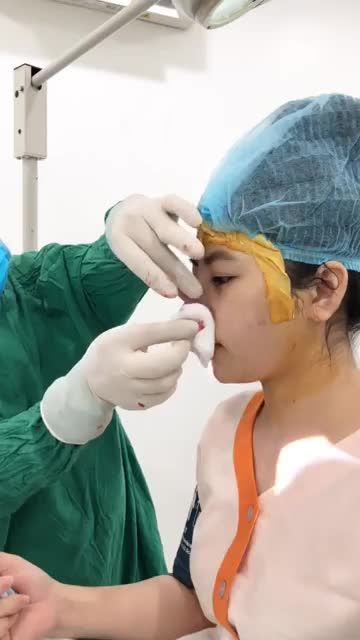 Tại AZ NOSE khách hàng được coi lại dáng mũi trước khi đóng vết khâu