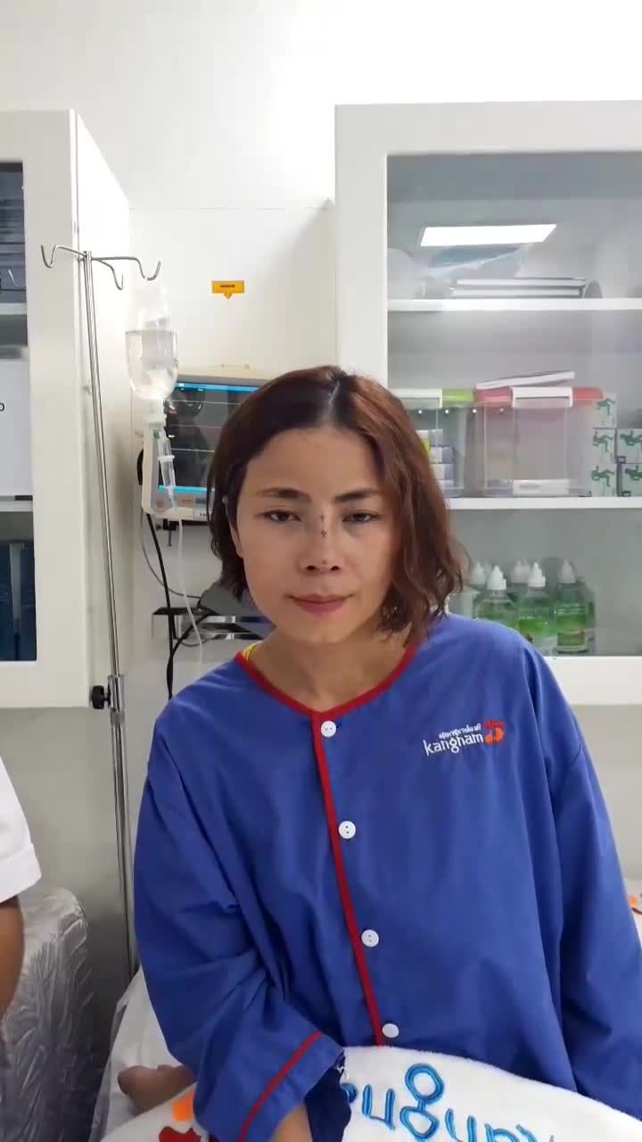 Mũi Sline cấu trúc 4D ngay sau 60 phút nâng mũi tại Kangnam
