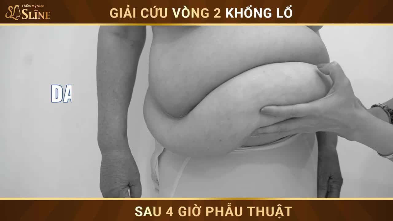 KẾT QỦA GIẢI CỨU VÒNG 2 QUÁ KHỔ