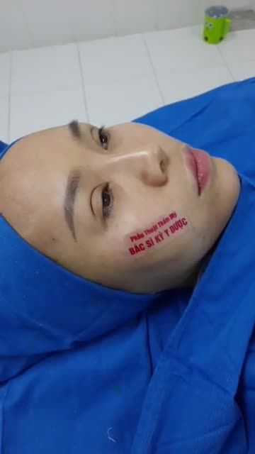 CÔNG NGHỆ TRẺ HÓA DA VÀ LÀM ĐẦY BẰNG MỠ TỰ THÂN