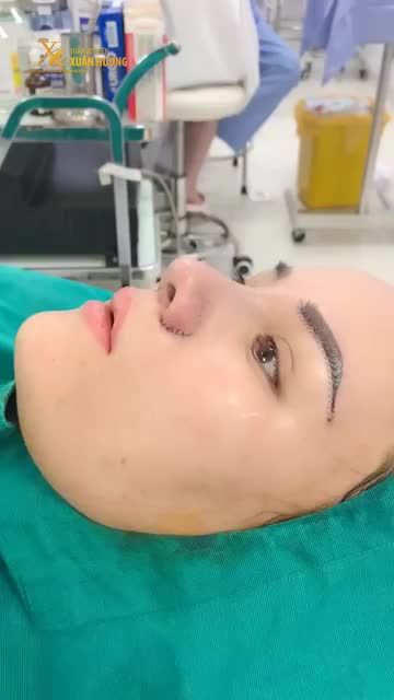 CÙNG LÚC SỬ DỤNG COMBO 4 DỊCH VỤ THẨM MỸ SẼ NHƯ THẾ NÀO?