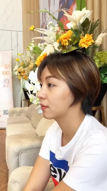 Mũi cấu trúc sau 2 năm như thế nào?