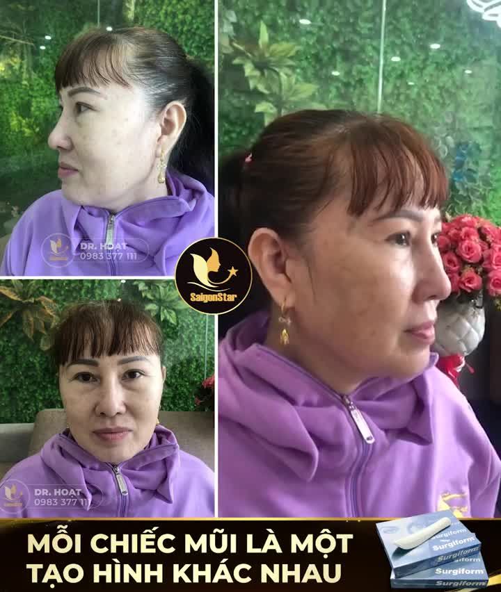 MỖI CHIẾC MŨI LÀ MỘT TẠO HÌNH KHÁC NHAU