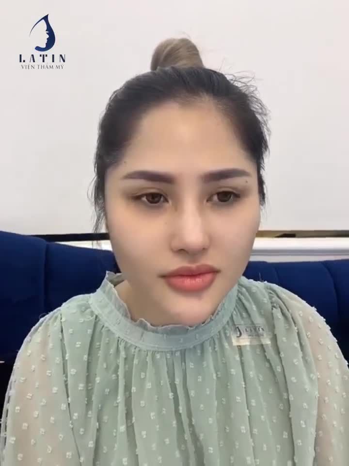 Mũi của chị Thảo Sương hôm trước Latin có nhá trước vài tấm hình.