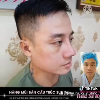 MŨI ĐẸP CHO NAM GIỚI AI CŨNG CÓ QUYỀN LÀM ĐẸP ĐẸP ĐỂ TỰ TIN VÀ HẠNH PHÚC