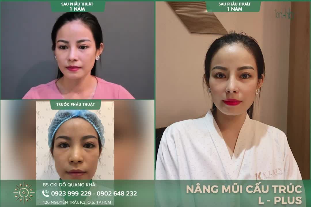 Người ta nâng mũi rần rần, Cớ sao tôi vẫn bần thần ngồi đây