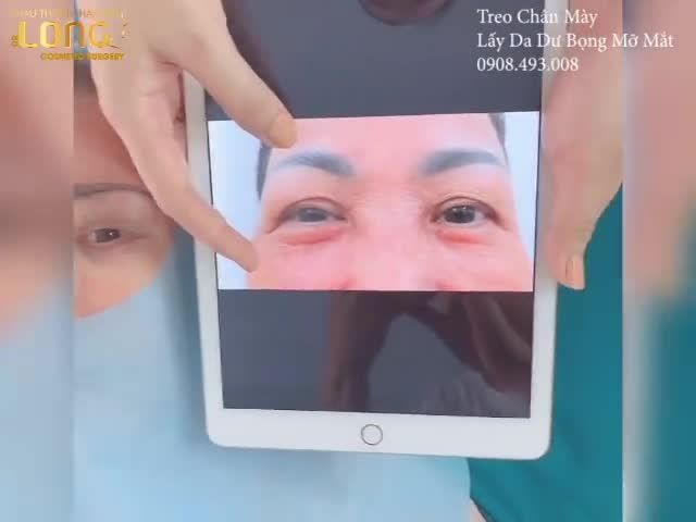 Tuổi có thể cao - nhưng đôi mắt thì phải luôn đẹp