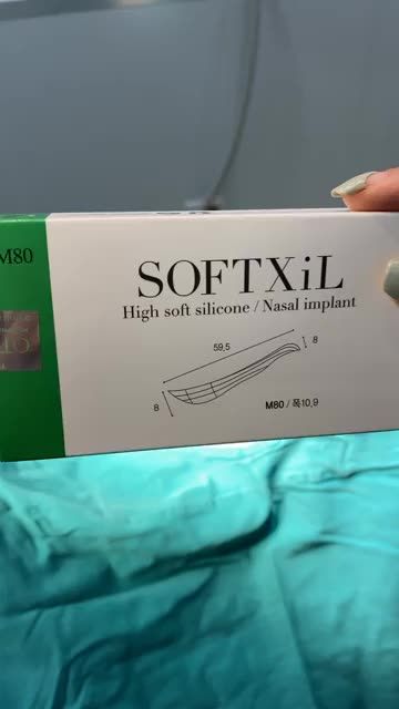 KẾT QUẢ SỬA DÁNG MŨI LỖI VỚI NÂNG MŨI CẤU TRÚC SOFTXIL
