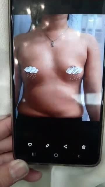 NÂNG NGỰC NỘI SOI CHÂN KHÔNG NHÀ BS KỲ Y DƯỢC CHƯA BAO GIỜ HẾT HOT