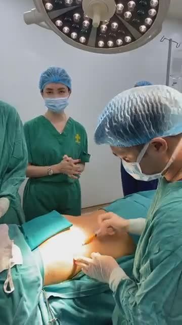 QUÁ TRÌNH “NHÀO NẶN” BODY GỢI CẢM CHO CHỊ KHÁCH HÀNG BẰNG DỊCH VỤ “HÚT MỠ EO SAU VÀ CẤY MỠ HÔNG”