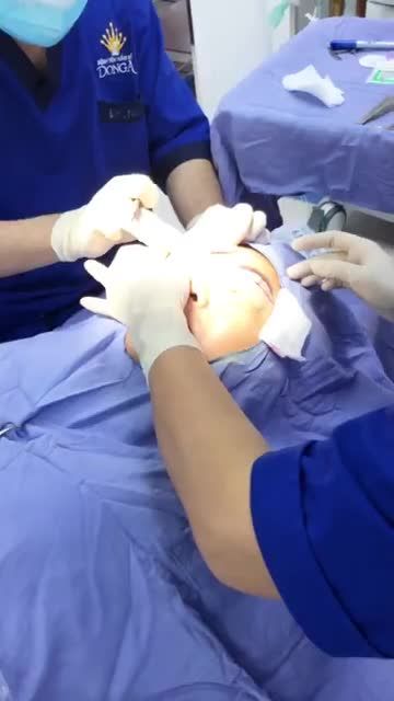 Quá trình thực hiện nâng cung mày tại BV thẩm Mỹ ĐÔNG Á