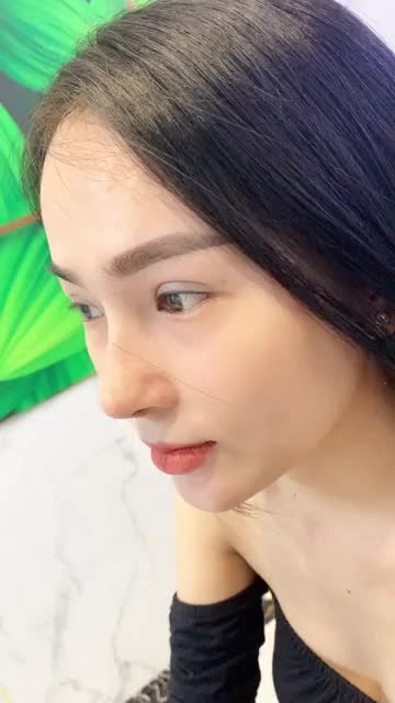 Dáng Mũi NANOFROM 4D mới có 10 ngày thôi dáng mũi đã Đẹp như này rồi ĐẶC BIỆT - KHÔNG XƯNG KHÔNG BẦM