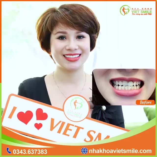 Em bọc sứ sau này có bị làm sao không?