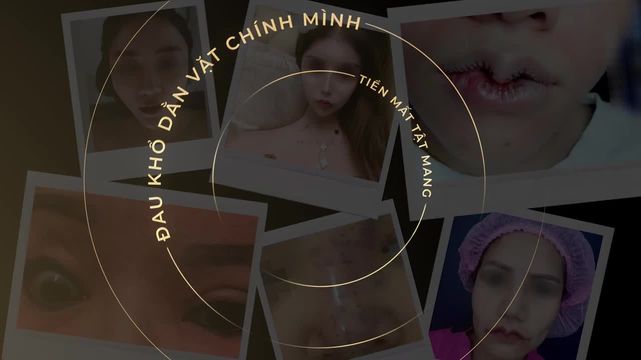 GIẢI CỨU THẨM MỸ LỖI - TÁI SINH TỪ NHỮNG TRO TÀN