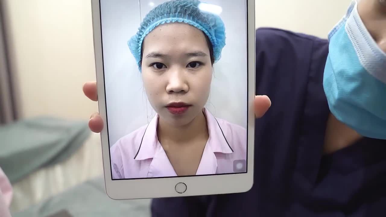 MŨI GỒ, ĐẦU MŨI TO, CÁNH MŨI BÈ VÀ CÁI KẾT SAU 45P tại Dr Minh Phạm 108!