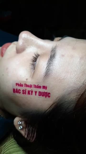 NÂNG MŨI CẤU TRÚC ĐA LỚP NHÀ BS KỲ ĐỂ TRỞ NÊN TỰ TIN VÀ XINH ĐEP