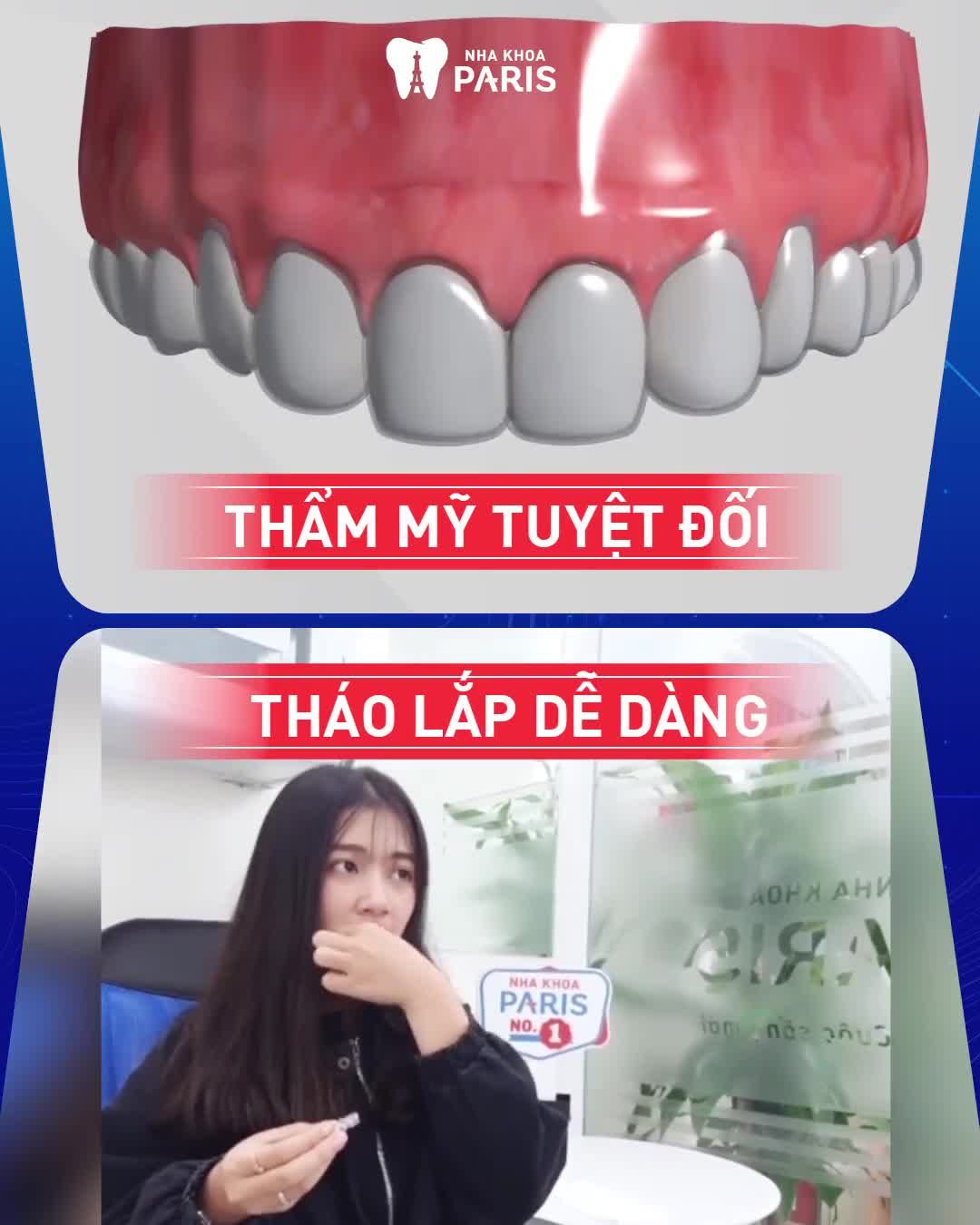 NIỀNG RĂNG SÀNH ĐIỆU CHỌN INVISALIGN