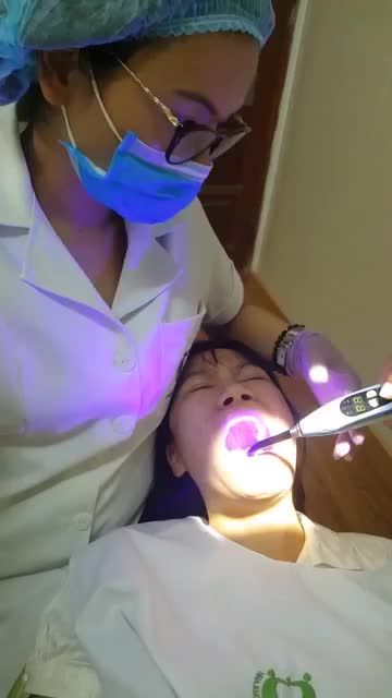 THẨM MỸ RĂNG CHO MỘT VỊ KHÁCH HÀNG TẠI CS 178 NGÔ GIA TỰ
