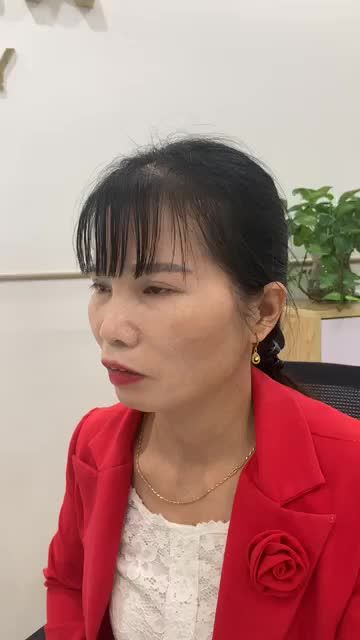 Tư vấn cho chị khách hàng mặt hốc hác tại BVTM Đông Á
