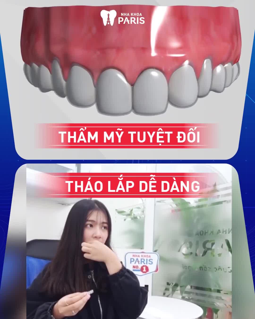 Niềng Răng Không Ai Biết CHỌN INVISALIGN
