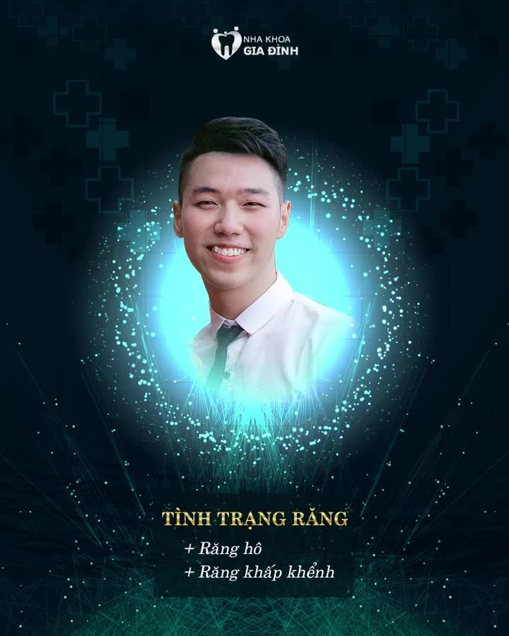 BỎ RA 2 NĂM NIỀNG RĂNG NHẬN VỀ VẺ NGOÀI NAM THẦN CUỐN HÚT