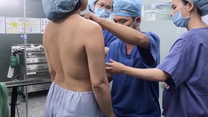 Đo vẽ tạo hình dáng ngực là quy trình quan trọng trước khi thực hiện dịch vụ nâng cấp V1.